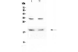 Western blot analysis of Pleiotrophin using anti-Pleiotrophin antibody . (Pleiotrophin 抗体  (AA 33-168))