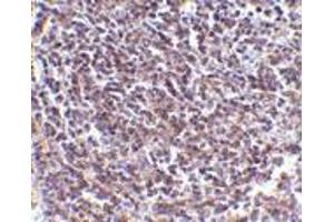 Immunohistochemistry of Aven in human spleen tissue with Aven antibody at 5 μg/ml. (AVEN 抗体  (N-Term))