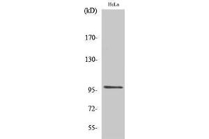 Western Blotting (WB) image for anti-Upstream Binding Transcription Factor, RNA Polymerase I (UBTF) (Internal Region) antibody (ABIN6284130)