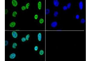 Immunofluorescence of Rabbit Anti-Histone H3 K4/me3 Antibody. (Histone 3 抗体  (H3K4me3))