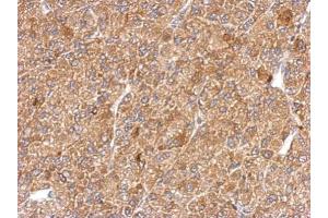 Immunohistochemistry (IHC) image for anti-Actin, alpha 2, Smooth Muscle, Aorta (ACTA2) (N-Term) antibody (ABIN2857027)