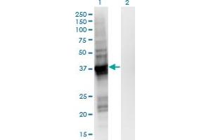 Western Blot analysis of GIPC2 expression in transfected 293T cell line by GIPC2 monoclonal antibody (M02), clone 4H8. (GIPC2 抗体  (AA 1-315))