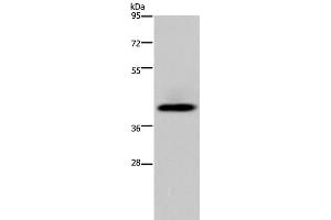 Western Blot analysis of Human fetal liver tissue using SERPINB3 Polyclonal Antibody at dilution of 1:200 (SERPINB3 抗体)