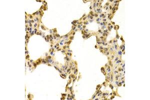 Immunohistochemistry (IHC) image for anti-DNA-Damage-Inducible Transcript 3 (DDIT3) (C-Term) antibody (ABIN3020710)