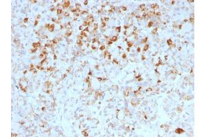 Formalin-fixed, paraffin-embedded human Pituitary stained with LH-beta Mouse Monoclonal Antibody (LHb/1214). (LHB 抗体)
