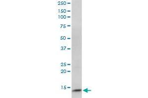 CIDEC monoclonal antibody (M07), clone 2E2. (CIDEC 抗体  (AA 53-141))