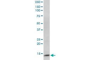 CIDEC monoclonal antibody (M07), clone 2E2. (CIDEC 抗体  (AA 53-141))