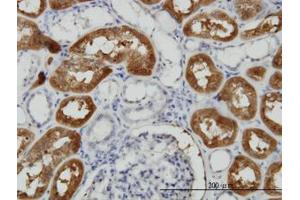 Image no. 4 for anti-Formiminotransferase Cyclodeaminase (FTCD) (AA 440-542) antibody (ABIN599156) (FTCD 抗体  (AA 440-542))