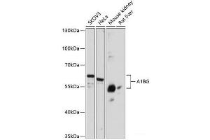 Western blot analysis of extracts of various cell lines using A1BG Polyclonal Antibody at dilution of 1:3000. (A1BG 抗体)