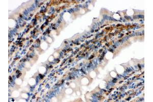 Anti- Cofilin Picoband antibody, IHC(P) IHC(P): Rat Intestine Tissue (Cofilin 抗体  (C-Term))