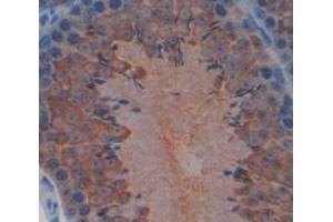 IHC-P analysis of Mouse Tissue, with DAB staining. (Hexokinase 1 抗体  (AA 137-270))
