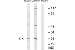 Western Blotting (WB) image for anti-BCL2-Interacting Killer (Apoptosis-Inducing) (BIK) (AA 18-67) antibody (ABIN2888586) (BIK 抗体  (AA 18-67))