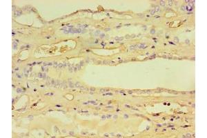 Immunohistochemistry of paraffin-embedded human kidney tissue using ABIN7157760 at dilution of 1:100 (CCBL1 抗体  (AA 1-372))