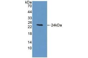 Detection of Recombinant BCKDK, Rat using Polyclonal Antibody to Branched Chain Alpha-Ketoacid Dehydrogenase Kinase (BCKDK) (BCKDK 抗体  (AA 44-223))