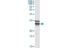 Immunoprecipitation of FGF21 transfected lysate using anti-FGF21 monoclonal antibody and Protein A Magnetic Bead , and immunoblotted with FGF21 MaxPab rabbit polyclonal antibody. (FGF21 抗体  (AA 30-209))