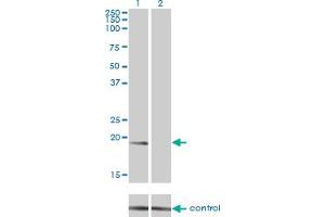 Western blot analysis of NME1 over-expressed 293 cell line, cotransfected with NME1 Validated Chimera RNAi (Lane 2) or non-transfected control (Lane 1). (NME1 抗体  (AA 1-152))