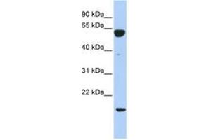 Image no. 1 for anti-Protein Tyrosine Phosphatase Type IVA, Member 3 (PTP4A3) (C-Term) antibody (ABIN6743577) (PTP4A3 抗体  (C-Term))