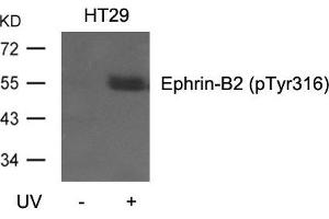 Western blot analysis of extracts from HT29 cells, untreated or treated with UV using Ephrin-B2(Phospho-Tyr316) Antibody. (Ephrin B2 抗体  (pTyr316))