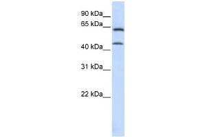 WB Suggested Anti-ChGn Antibody Titration:  0. (CSGALNACT1 抗体  (C-Term))