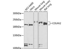 Western blot analysis of extracts of various cell lines, using COL4 antibody (ABIN6134493, ABIN6138843, ABIN6138844 and ABIN6223578) at 1:500 dilution.