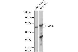Western blot analysis of extracts of various cell lines, using WNT2 Antibody (ABIN6134457, ABIN6150238, ABIN6150240 and ABIN6217609) at 1:1000 dilution. (WNT2 抗体  (AA 1-100))