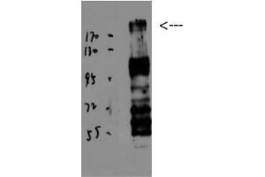 Western Blot (WB) analysis of JK using BRCA1 Polyclonal Antibody diluted at 1:1000. (BRCA1 抗体  (Ser184, Ser186))