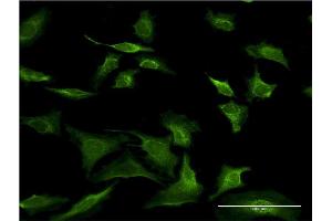 Immunofluorescence of monoclonal antibody to SEC63 on HeLa cell. (SEC63 抗体  (AA 631-728))