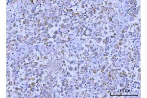 IHC analysis of Hamartin/TSC1 using anti-Hamartin/TSC1 antibody (ABIN7599499). (TSC1 抗体  (AA 1-618))