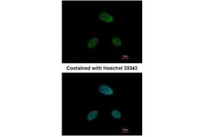 ICC/IF Image Immunofluorescence analysis of paraformaldehyde-fixed HeLa, using DRAK1, antibody at 1:500 dilution. (STK17A 抗体)