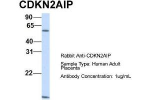 Host:  Rabbit  Target Name:  CDKN2AIP  Sample Type:  Human Adult Placenta  Antibody Dilution:  1.