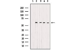 Western blot analysis of extracts from various samples, using CS061 Antibody. (SMG9 抗体  (Internal Region))