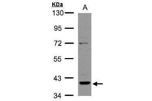 WB Image Sample(30 ug whole cell lysate) A:Raji , 10% SDS PAGE antibody diluted at 1:2000 (RAD51 Homolog B 抗体  (Center))