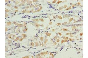 Immunohistochemistry (IHC) image for anti-Smg-6 Homolog, Nonsense Mediated mRNA Decay Factor (SMG6) (AA 251-511) antibody (ABIN7171717)