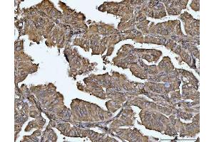 IHC analysis of VPS53 using anti-VPS53 antibody (ABIN7599731).