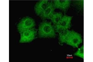 Immunofluorescence analysis of paraformaldehyde-fixed A549, using GAPDH antibody at 1:200 dilution. (GAPDH 抗体  (AA 9-323))