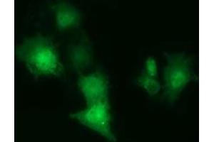 Anti-CBWD1 mouse monoclonal antibody (ABIN2452882) immunofluorescent staining of COS7 cells transiently transfected by pCMV6-ENTRY CBWD1 (RC222790). (CBWD1 抗体)