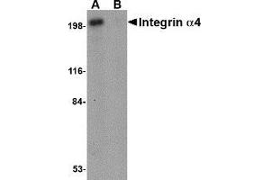 Western blot analysis of Integrin alpha 4 in Jurkat cell lysate with AP30434PU-N Integrin alpha 4 antibody at 1 μg/ml in (A) the absence and (B) the presence of blocking peptide.