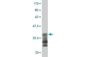 Western Blot detection against Immunogen (37.