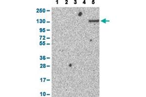 Western Blot analysis with ENPP1 polyclonal antibody . (ENPP1 抗体  (AA 96-149))