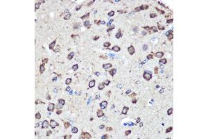 Immunohistochemistry of paraffin-embedded Rat brain using LRRK2 Rabbit pAb  at dilution of 1:100 (40x lens). (LRRK2 抗体  (AA 2355-2527))