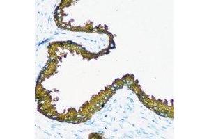 Immunohistochemical analysis of RRM1 staining in human prostate formalin fixed paraffin embedded tissue section. (RRM1 抗体)