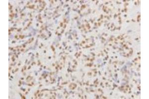 Immunohistochemistry (Paraffin-embedded Sections) (IHC (p)) image for anti-Protein Kinase, DNA-Activated, Catalytic Polypeptide (PRKDC) (Catalytic Subunit) antibody (ABIN1854884) (PRKDC 抗体  (Catalytic Subunit))
