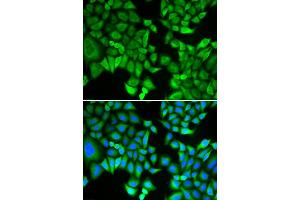 Immunofluorescence analysis of A549 cell using KPNA2 antibody. (KPNA2 抗体)