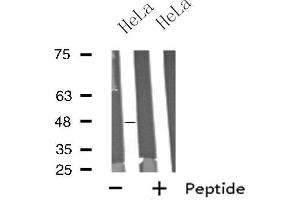 Western blot analysis of extracts from HeLa cells using SCTR antibody. (SCTR 抗体  (Internal Region))