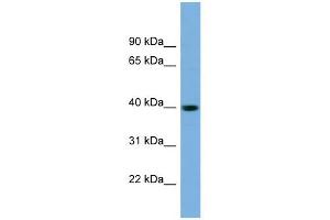 SAE1 antibody used at 1 ug/ml to detect target protein. (SAE1 抗体  (N-Term))