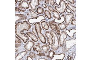 Immunohistochemical staining of human kidney with XPO6 polyclonal antibody  shows strong cytoplasmic positivity in cells of tubules. (Exportin 6 抗体)