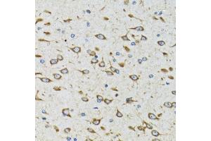 Immunohistochemistry of paraffin-embedded rat brain using AKTIP antibody (ABIN6131091, ABIN6136746, ABIN6136748 and ABIN6221837) at dilution of 1:100 (40x lens). (AKTIP 抗体  (AA 1-292))