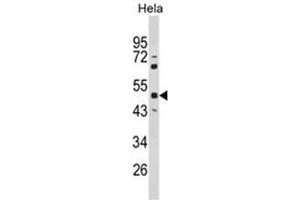 Western blot analysis of PAX6 Antibody (Center) in Hela cell line lysates (35ug/lane). (PAX6 抗体  (Middle Region))