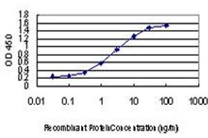 Detection limit for recombinant GST tagged CDKL1 is approximately 0. (CDKL1 抗体  (AA 259-358))