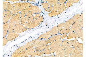ABIN6262017 and ABIN6279469 at 1/100 staining Rat skin tissue by IHC-P.